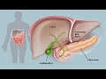 9 Warning Signs and Symptoms of Gallbladder Stones !!