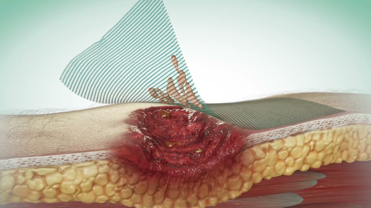 Curativo Essity Cutimed Sorbact Swabs Antimicrobiano - Vitae Saúde