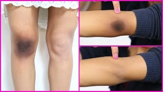 Dark Knees & Elbows Whitening (LIVE RESULTS) | Anaysa screenshot 5