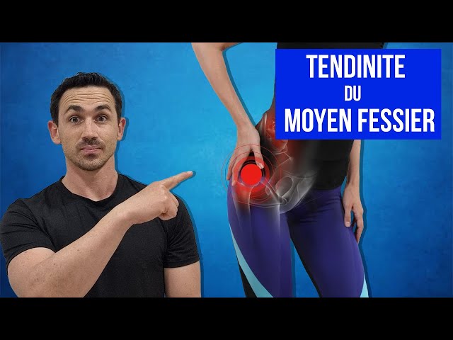 Tendinite du Moyen Fessier : Traitements, Étirements et Exercices Kiné