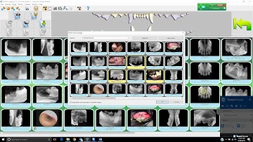 Sopix SOPRO Imaging: Exporting Images from Software