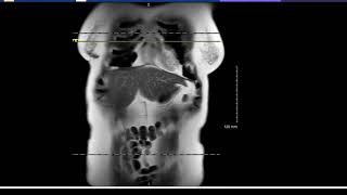 Don't overlook the margins of the images Matt Davenport