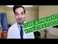 Athlete's Foot | How To Cure Athlete's Foot | Athlete's Foot Cream (2019)