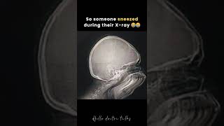 So Someone Sneezed During Their X-Ray
