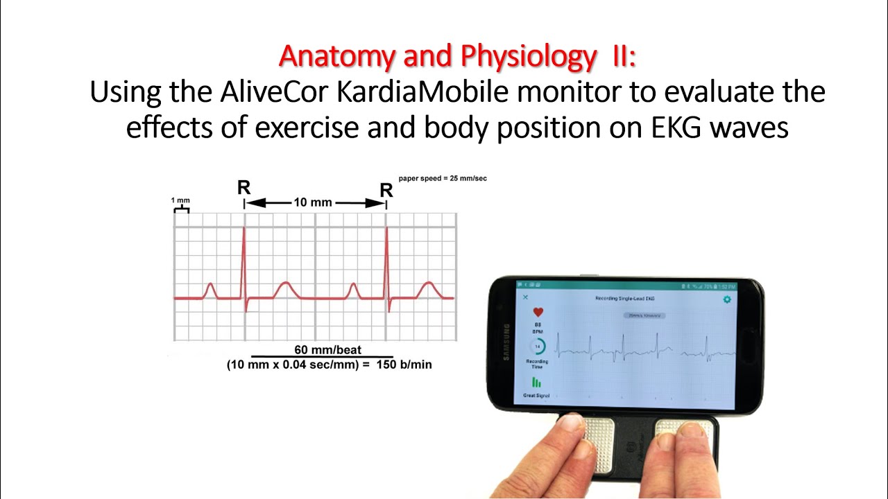 EKG Lab: Using the AliveCor KardiaMobile monitor to evaluate the effects of  exercise and body 