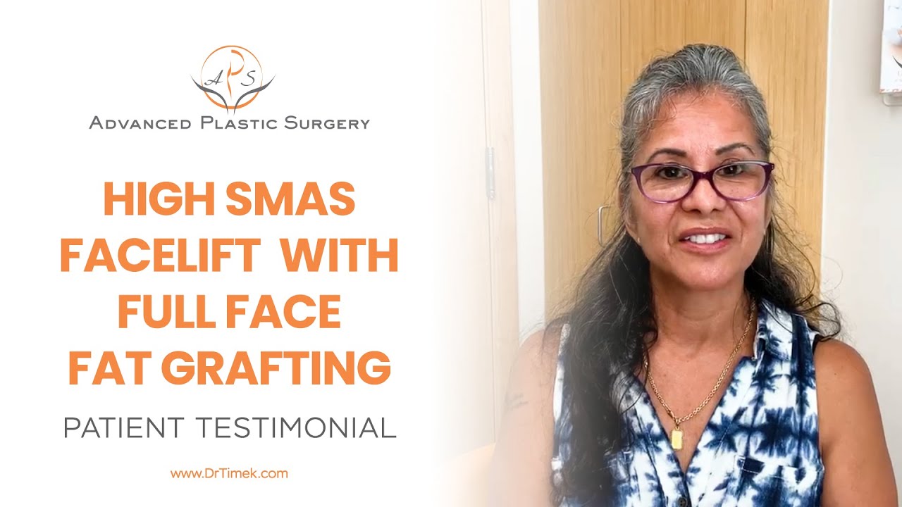 Face Lift + Full Face Fat Grafting | Dr. Ewa Timek | Advanced Plastic Surgery Grand Rapids, Mi