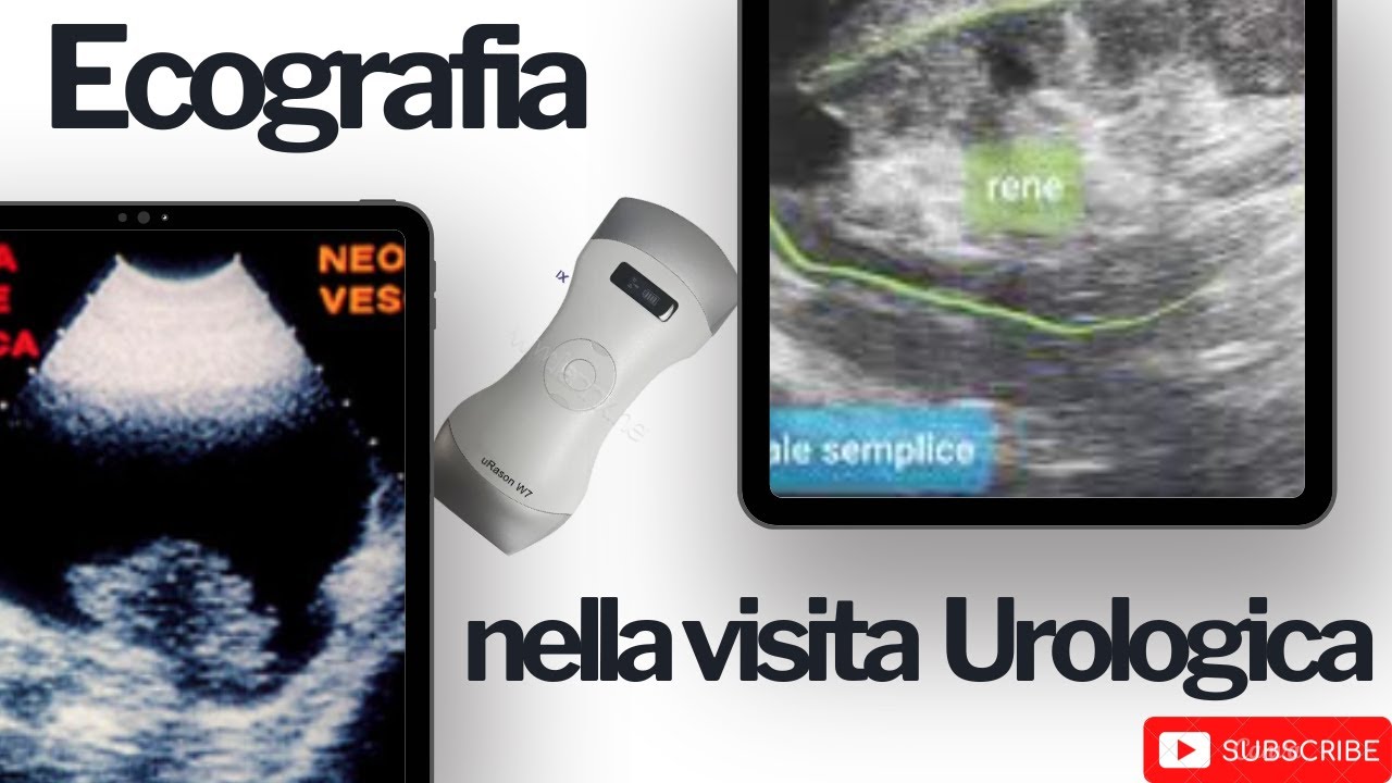 L'ecografia nella visita urologica. Cosa controlliamo nella prima visita urologica