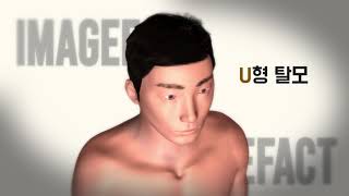 탈모가 의심된다면? ,탈모인이 봐야 할 영상