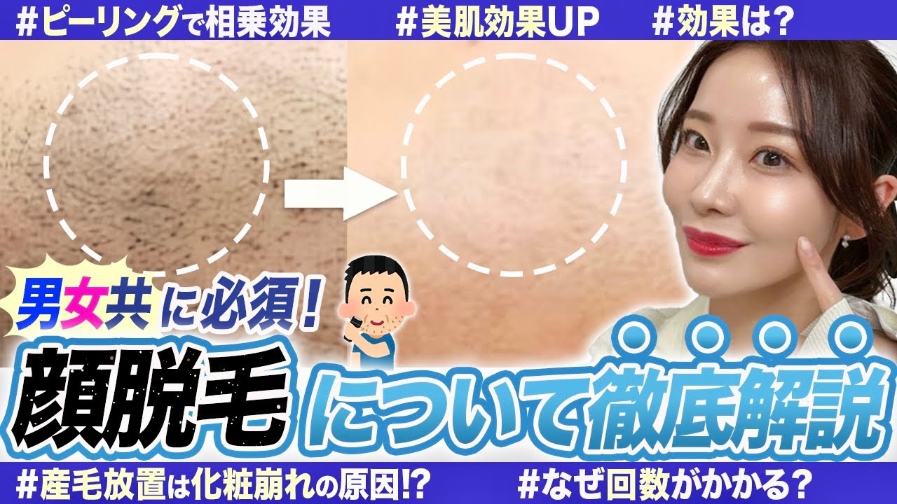 【毛穴改善+脱毛本音レポ】医療用ピーリング+顔脱毛の効果について徹底解説。痛み メカニズム  なぜ回数がかかるのか。弟に協力して頂きました