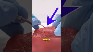 Comment If You Need This Injection