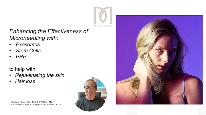 Exosomes, Stem cells, PRP Microneedling for skin rejuvenation & hair loss Dr  Michael Lau   IntimMed