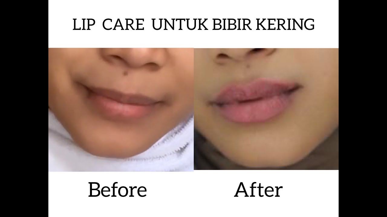 LIP CARE UNTUK BIBIR KERING YouTube