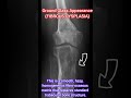 #physiotherapist #doctor #medical #medico #physio #medicalstudent #xray #viral #viralvideo #fyp #fy