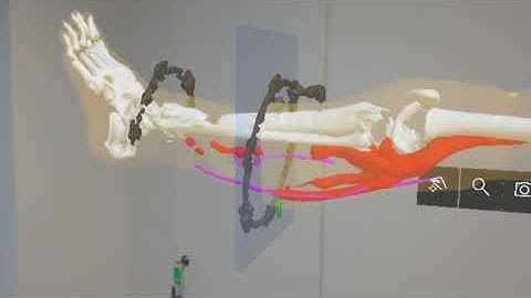 Augmented Reality anatomy app + CT scan viewer