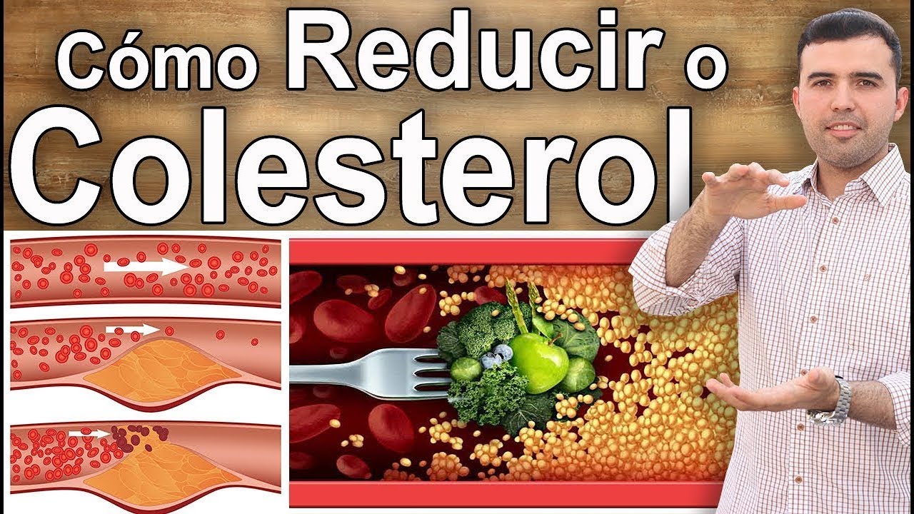 Como Reduzir o Colesterol Alto Naturalmente - Dieta, Suplementos Para ...