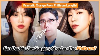 [EN/JP/TH/ SUB] Can Double Jaw Surgery Shorten the Philtrum