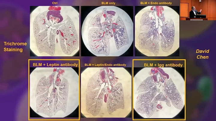 CTSI Distinguished Speaker Series I Philipp Scherer