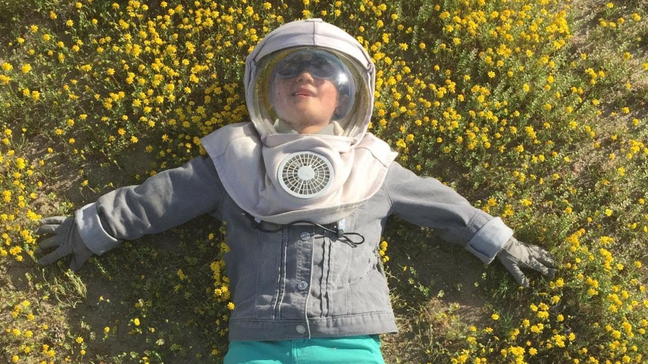 Meet Boy Allergic To The Sun YouTube Meet boy allergic to the sun youtube
