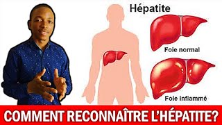 PRINCIPAUX SYMPTÔMES DE L’HÉPATITE (Dr Eyetemou Miguel, Pharmacien)