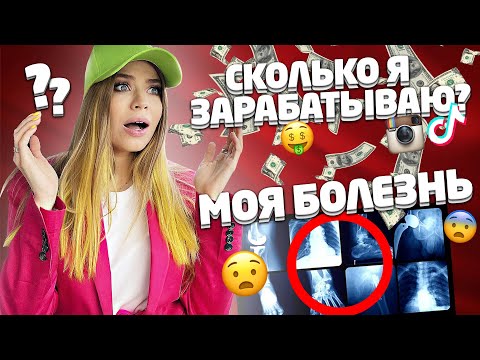 видео: СКОЛЬКО Я ЗАРАБАТЫВАЮ ! МОЯ БОЛЕЗНЬ ! ВОПРОС-ОТВЕТ !