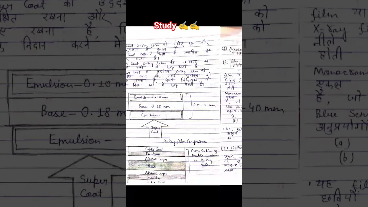 X Ray Radiophysics X Ray Film ✍️✍️ Good Morning Dosto 🌅 Radhey Radhey 🙏❤️Jay Shree Krishna 🙏Jay Hind