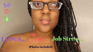 Lupus Stress and Jobs