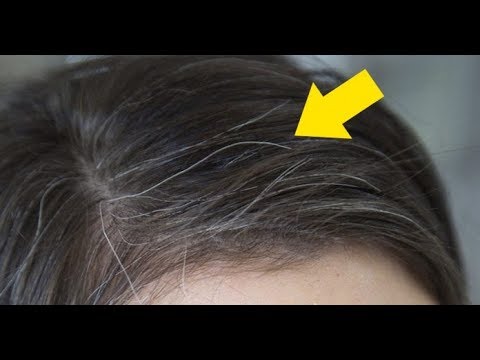 remedios naturales para la artritis Como eliminar las canas