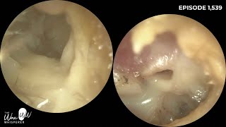 1,539 - Itchy Ear? Visit your Doctor, Audiologist or ENT