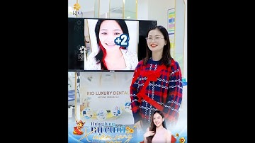 Niềng Răng "Vượt Ngàn Chông Gai", Thành Công "Lột Xác" Nụ Cười