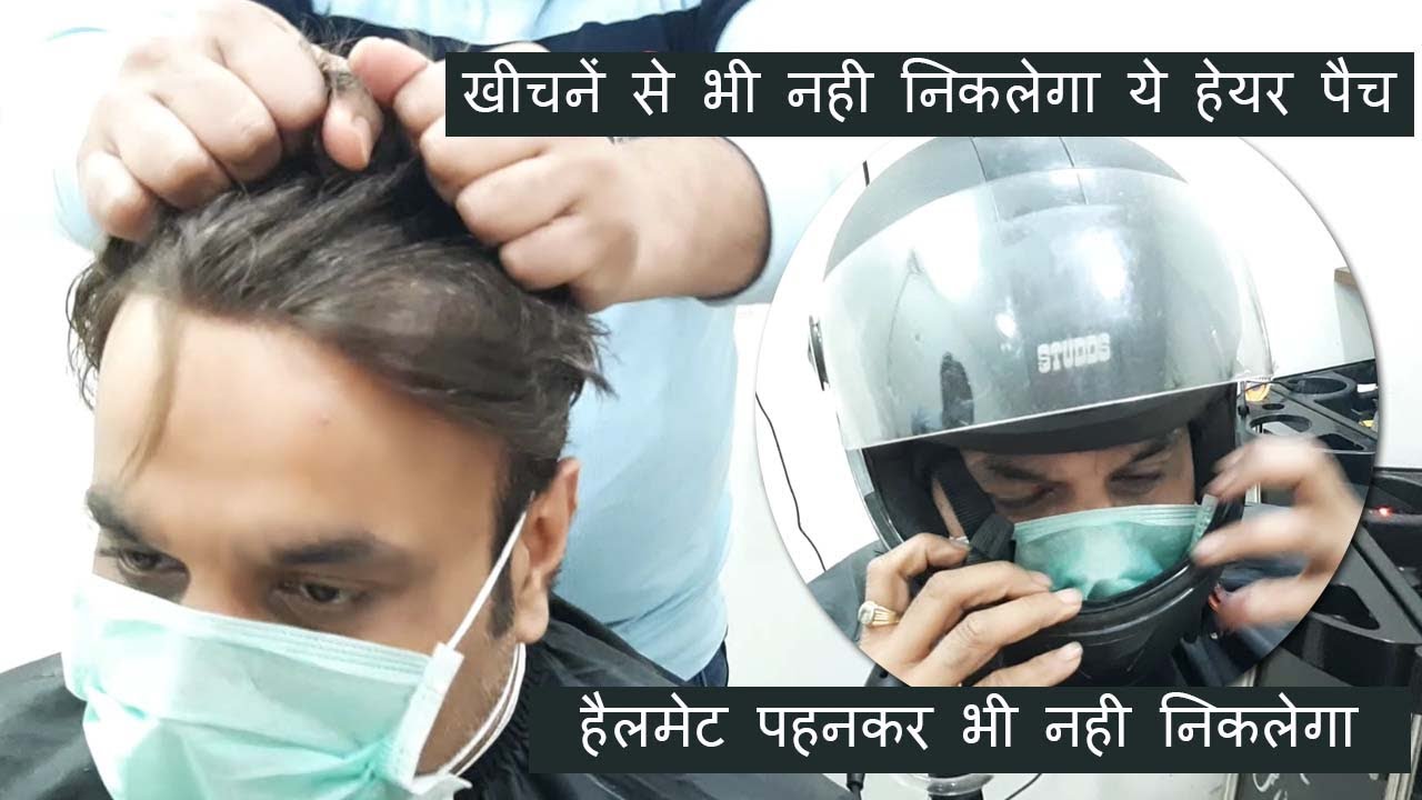 Hair Wigs Patches Life, Strongness, Helmet Stretch of Hair Patch Explained by Planet of Hair Cloning