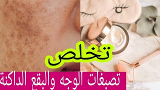 #وجه#skin#تصبغات_الوجه# اقوى وصفة طبيعية للتخلص من تصبغات الوجه وبقع  داكنة في 3 أيام