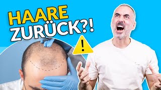 HAARTRANSPLANTATION – So läuft der Eingriff ab -  Bericht von Prof. Sinis | Plastic Surgery Coach