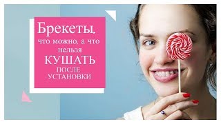 Брекеты: что можно и что нельзя кушать после установки Брекеты: что можно и что нельзя кушать после установки