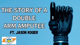 I Lost BOTH My Arms The Story of a Bilateral Amputee ft Jason Koger