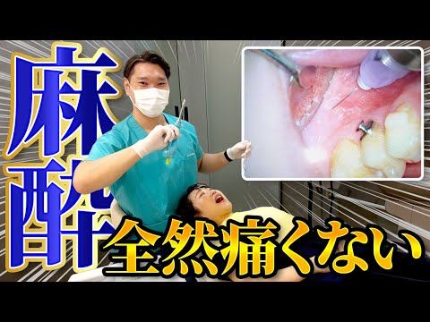 麻酔が痛くない理由