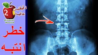 علاقه فيتامين د بالكالسيوم والسكري وضغط الدم والحساسيه والكوليسترول والعظام. وما هي البدائل