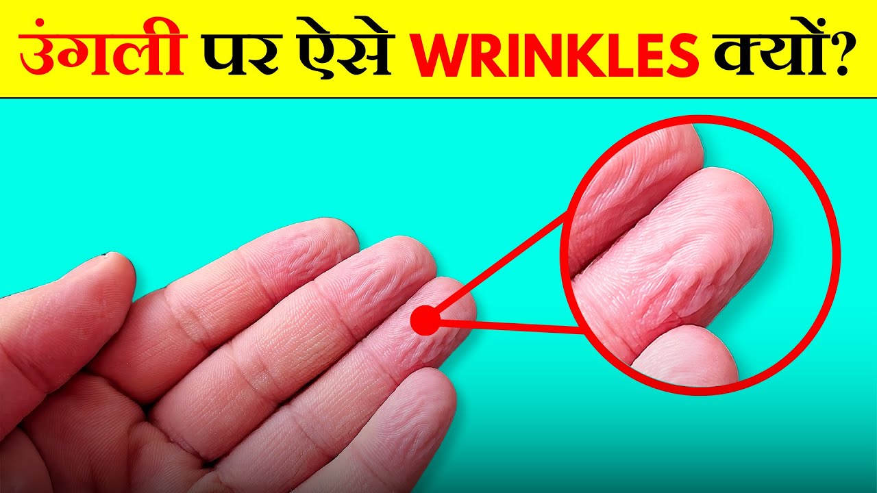 Why Do Our Fingers Wrinkle in Water? | Info&Fact
