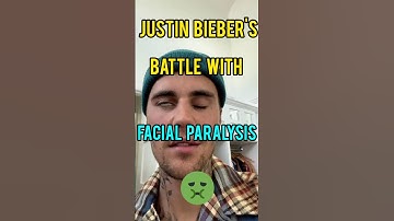 Justin Bieber’s Battle with Facial Paralysis #shorts #fitness #motivation #celebrity #trending #new
