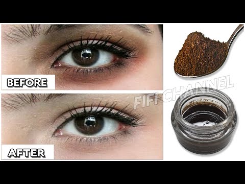 How to Remove Dark Circles and Eye Bags Naturally in 3 Days (100% Results)