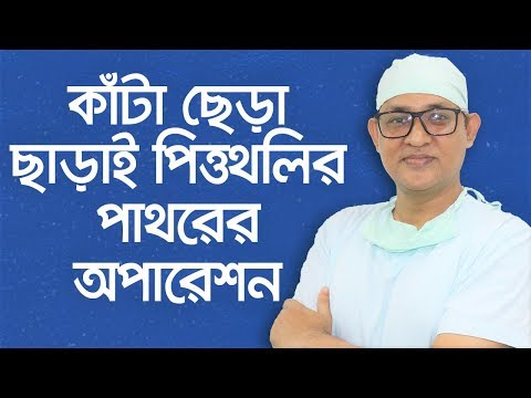 ভিডিও: কীভাবে অস্ত্রোপচার ছাড়াই পিত্তথলির পাথর থেকে মুক্তি পাবেন