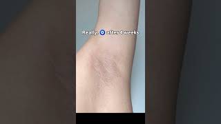 Famous underarm whitening roll-on #bodycare #skincareroutine #beauty #fyp #explore #shorts Net Worth