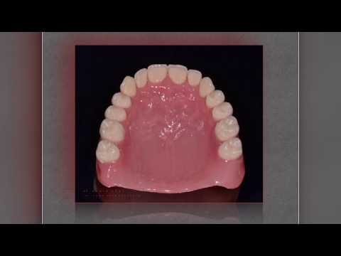 видео: Протезирование при полном отсутствии зубов | СЦ «Дентика»