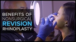 Nonsurgical Revision Rhinoplasty In San Francisco: OK After Past Surgery?
