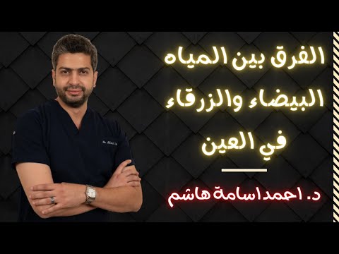 الفرق بين المياه البيضاء والزرقاء في العين د أحمد اسامة