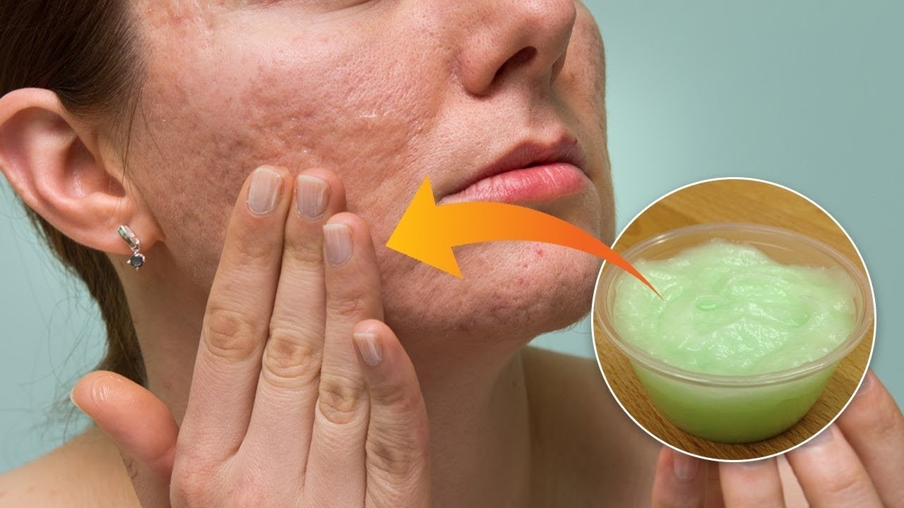 аллергичная кожа уход.