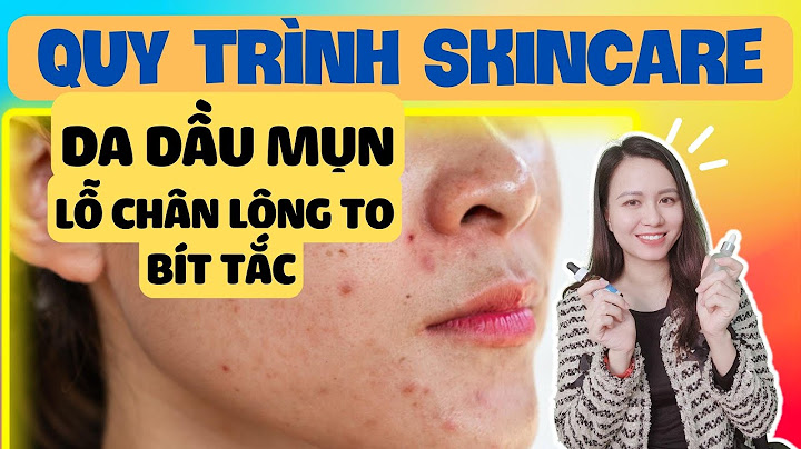 Hướng dẫn cách chăm sóc da mặt bị mụn năm 2024