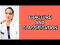 Classification of fracture simple open closed transverse oblique spiral comminuted