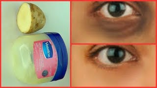 3 INGREDIENTS THAT CAN CLEAR DARK CIRCLES, SHRINK EYE BAGS AND PUFFY EYES WHILE GETTING RID OF WRINK