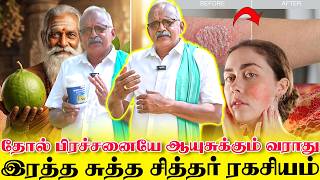 தோல் நோய்கள் ஆயுசுக்கும் வராத ரகசியம் 😱 ரத்தத்தை சுத்தம் செய்யும் சித்தர் மருந்து | Yogam