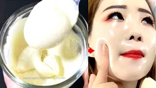 जादुई Cream जो Skin को Fair,Glowing और Spotless बनाती है|दाग़ धब्बे हटाने का रामबाण इलाज Shiny Skin